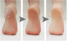 Carregar imagem no visualizador da galeria, Max Pé - Dê adeus aos calos e pés rachados
